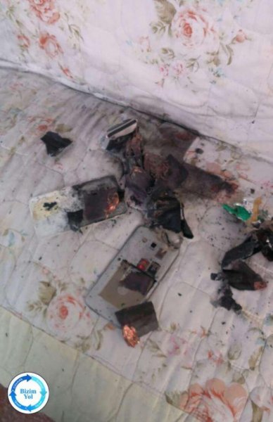Bakı sakininin telefonu partladı, uşağın dili tutuldu -FOTO
