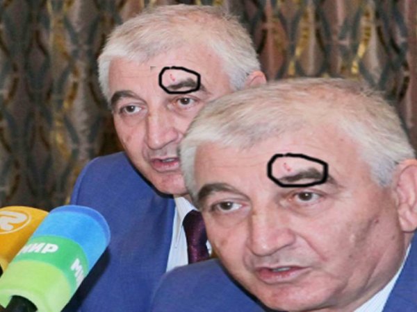 Məzahir Pənahov qəza keçirdi, alnı zədələndi - FOTO Məzahir Pənahov qəza keçirdi, alnı zədələndi - FOTO