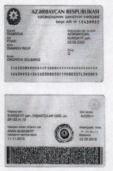 Azərbaycanda bir ailənin faciəsi: müalicə xərclərinə görə 14 yaşlı qızının Türkiyədən çıxışına qadağa qoyuldu - FOTO