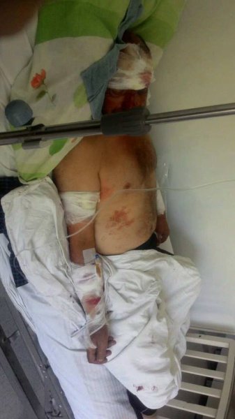 Azərbaycanda dəhşətli olay: sahibsiz itlər 65 yaşlı kişini parçaladı — FOTO Azərbaycanda dəhşətli olay: sahibsiz itlər 65 yaşlı kişini parçaladı — FOTO