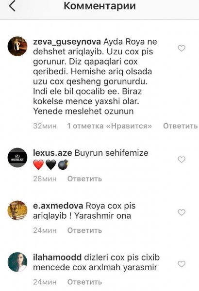 Röya elə dəyişdi ki... - FOTO