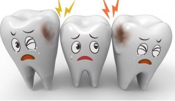 Kariesdən necə qorunmaq olar? - "AQS dental center”dən TÖVSİYƏ Kariesdən necə qorunmaq olar? - "AQS dental center”dən TÖVSİYƏ