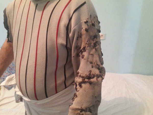 Sarayda çörək sexində partlayış olub, 3 nəfər ağır yaralanıb - FOTO Sarayda çörək sexində partlayış olub, 3 nəfər ağır yaralanıb - FOTO