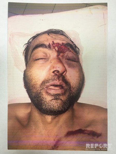 Abşeronda piyadanı maşın vuraraq öldürüb - FOTO Abşeronda piyadanı maşın vuraraq öldürüb - FOTO