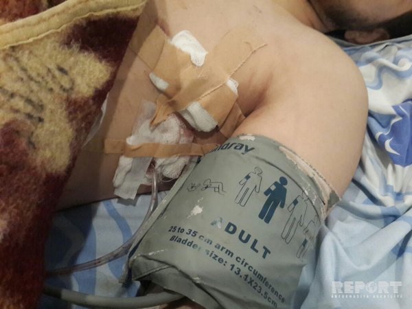 Sumqayıtda qonşular arasında kütləvi dava: 2 nəfər bıçaqlandı - FOTO Sumqayıtda qonşular arasında kütləvi dava: 2 nəfər bıçaqlandı - FOTO