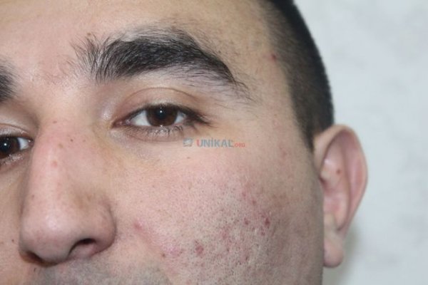 Jurnalist nazir müavininin dəfnində döyüldü Jurnalist nazir müavininin dəfnində döyüldü