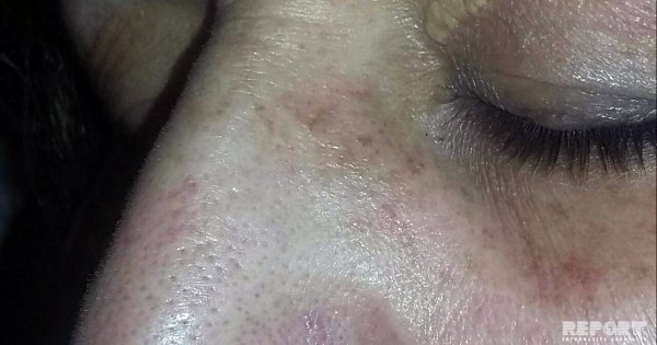 Sumqayıtda qadın ərini döyməsi xəbərindən danışdı - FOTO