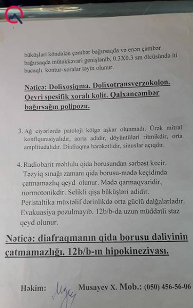 Sumqayıtın deputatının qızından şikayət: "İynəni arvadımın qarnında saxlamışdı"