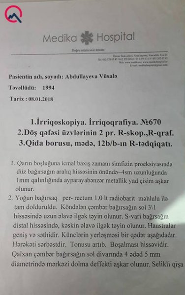 Sumqayıtın deputatının qızından şikayət: "İynəni arvadımın qarnında saxlamışdı"