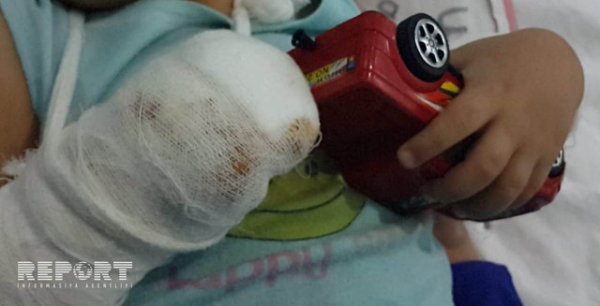 Sumqayıtda azyaşlının barmaqlarını ətçəkən maşın doğrayıb – FOTO Sumqayıtda azyaşlının barmaqlarını ətçəkən maşın doğrayıb – FOTO