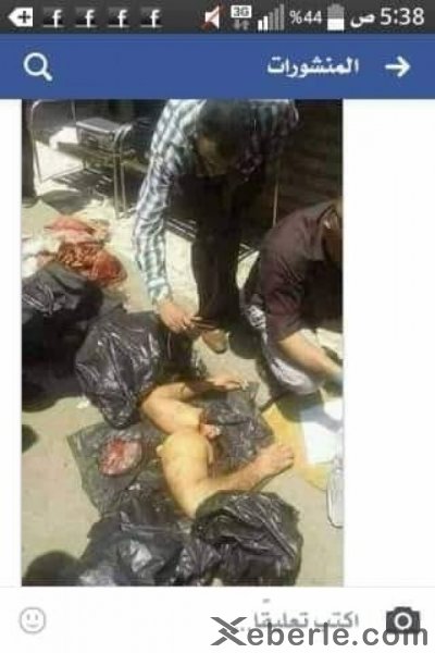 Camalın hissələrə bölünmüş cəsədi aşkarlandı: tikə-tikə doğrayıb,üzünün dərisini soyublar – FOTOLAR