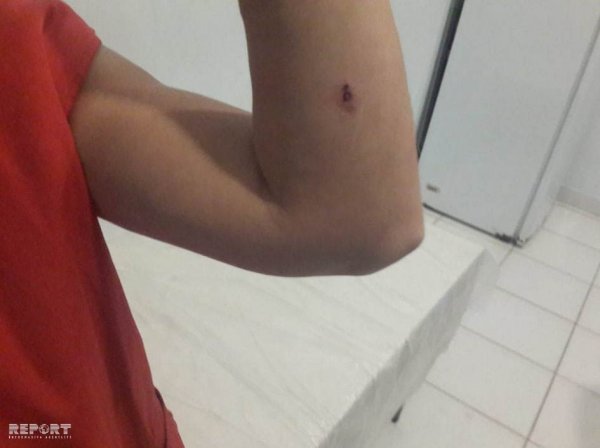 Sumqayıtda qonşu qadınlar arasında bıçaqlaşma olub - FOTO