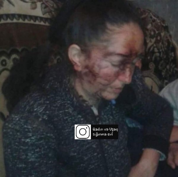 Şəmkirdə ər arvadını yatdığı yerdə vəhşicəsinə döydü - FOTO