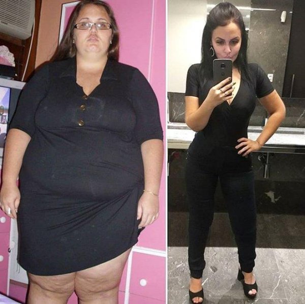 Kök olduğu üçün yataqdan dura bilmirdi - 90 kiloqram arıqlayıb model oldu (FOTO) Kök olduğu üçün yataqdan dura bilmirdi - 90 kiloqram arıqlayıb model oldu (FOTO)