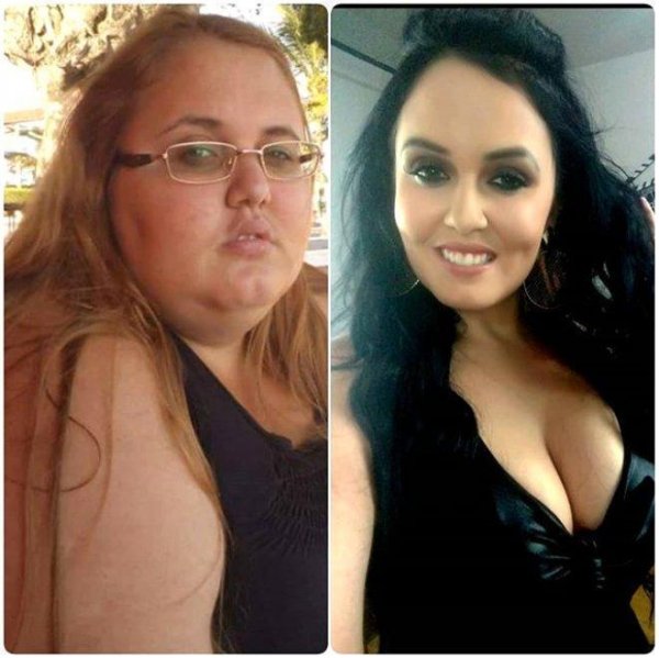 Kök olduğu üçün yataqdan dura bilmirdi - 90 kiloqram arıqlayıb model oldu (FOTO) Kök olduğu üçün yataqdan dura bilmirdi - 90 kiloqram arıqlayıb model oldu (FOTO)
