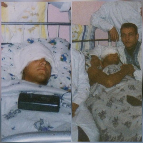 On beş gün komada qalmış sumqayıtlı qazinin 20 il əvvəlki FOTOSU