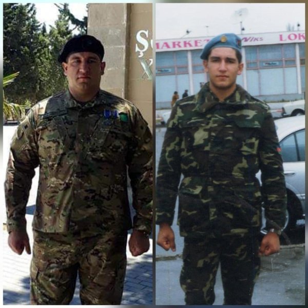 On beş gün komada qalmış sumqayıtlı qazinin 20 il əvvəlki FOTOSU