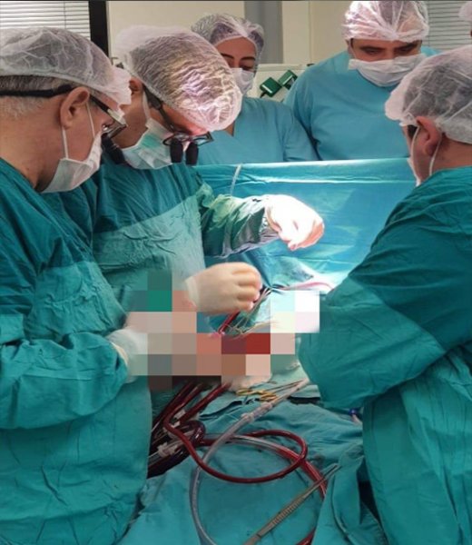 Azərbaycanda inanılmaz əməliyyat: xəstəyə süni ürək köçürülüb - FOTO