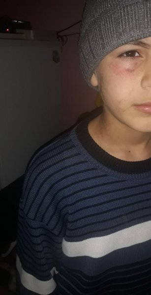 Dövlət Komitəsi anası tərəfindən döyüldüyü deyilən uşaqla bağlı araşdırmalara başlayıb