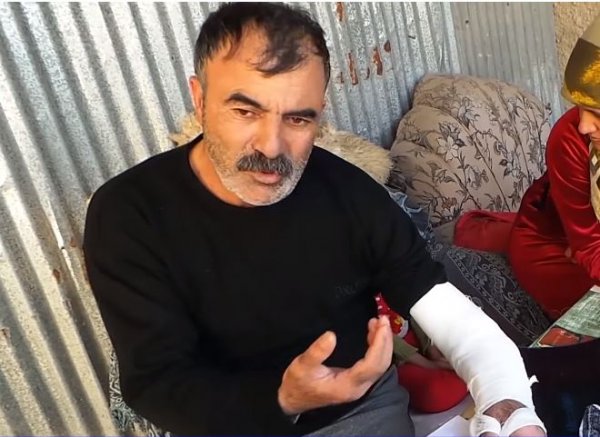 Sumqayıtda həkim xəstənin qolunu kəsib? - İDDİA (VİDEO)