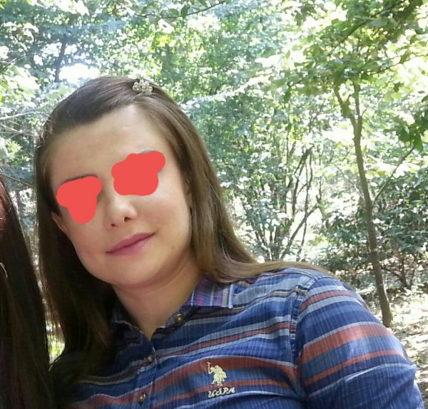 Türkiyədə burnu yalnış əməliyyat olunan azərbaycanlı qadın səfirə müraciət etdi -FOTO