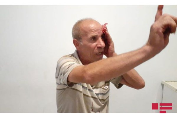 Sumqayıtda xalq artistinin qardaşını döydülər - FOTO