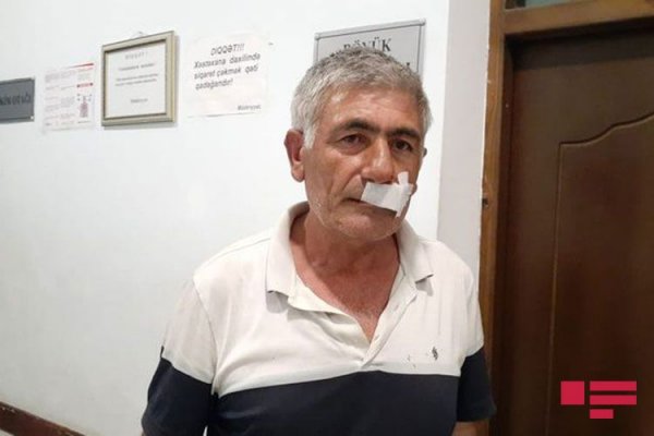 Sumqayıtda xalq artistinin qardaşını döydülər - FOTO