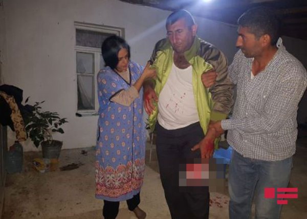Ermənilərin yaraladığı mülki vətəndaşımızın FOTOSU