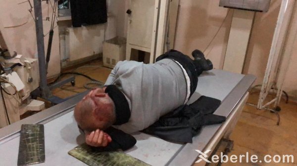 Sumqayıtda xalq artistinin qardaşı özünü maşının altına atdı - FOTO