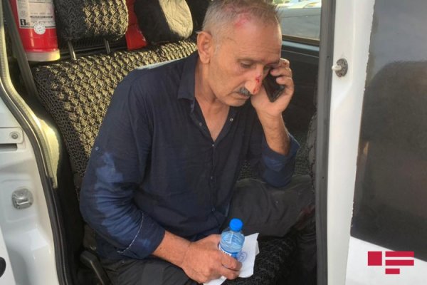 Bakı-Sumqayıt yolunda ağır qəza: 3 nəfər yaralandı – FOTOLAR