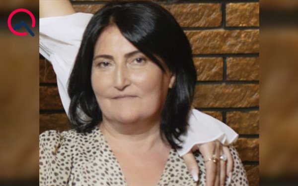 Sumqayıtda burun əməliyyatına girən qadının gözündə çəplik yarandı - FOTO Sumqayıtda burun əməliyyatına girən qadının gözündə çəplik yarandı - FOTO